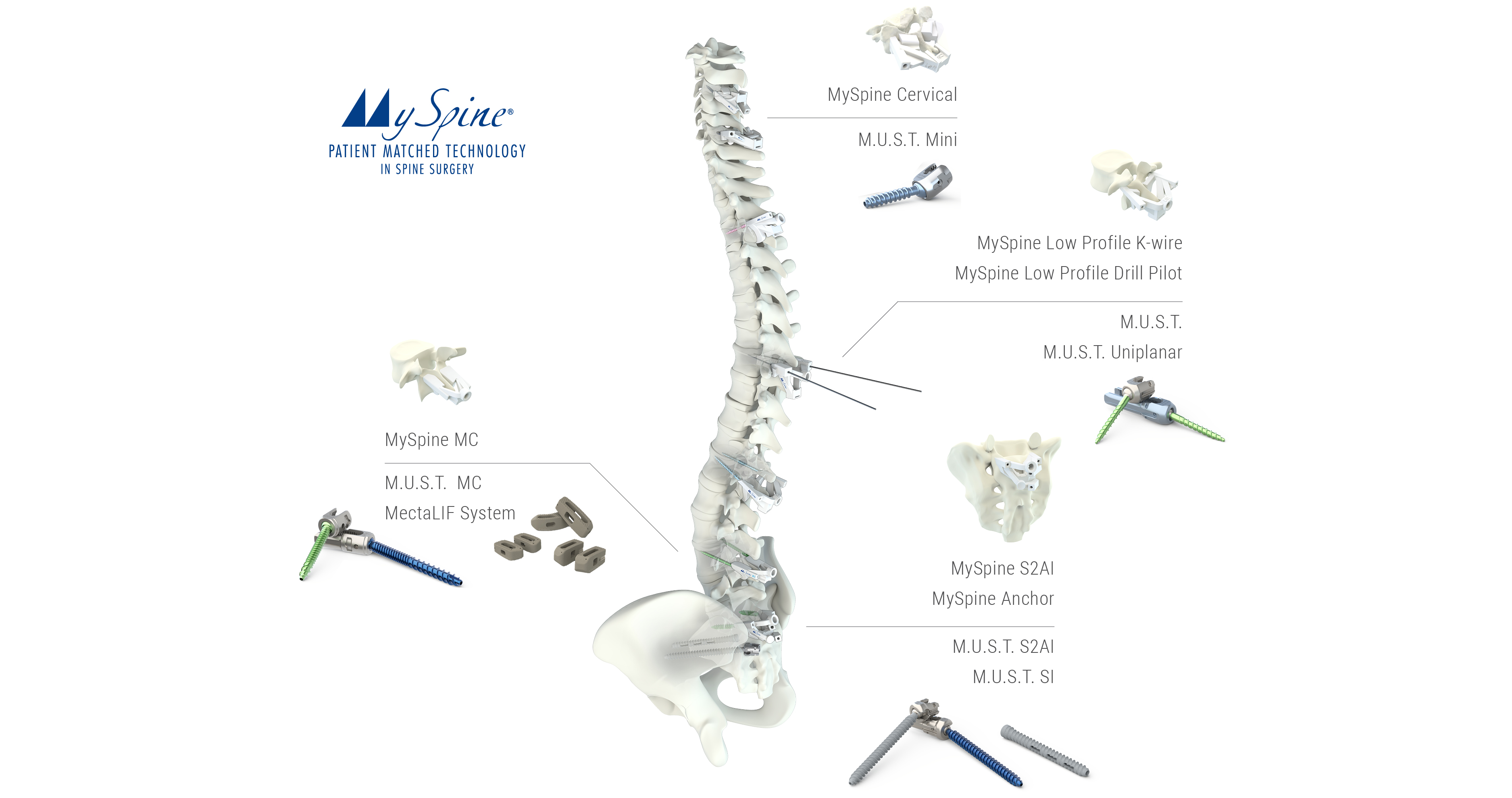 MySpine - Patient Matched Technology in Spine Surgery