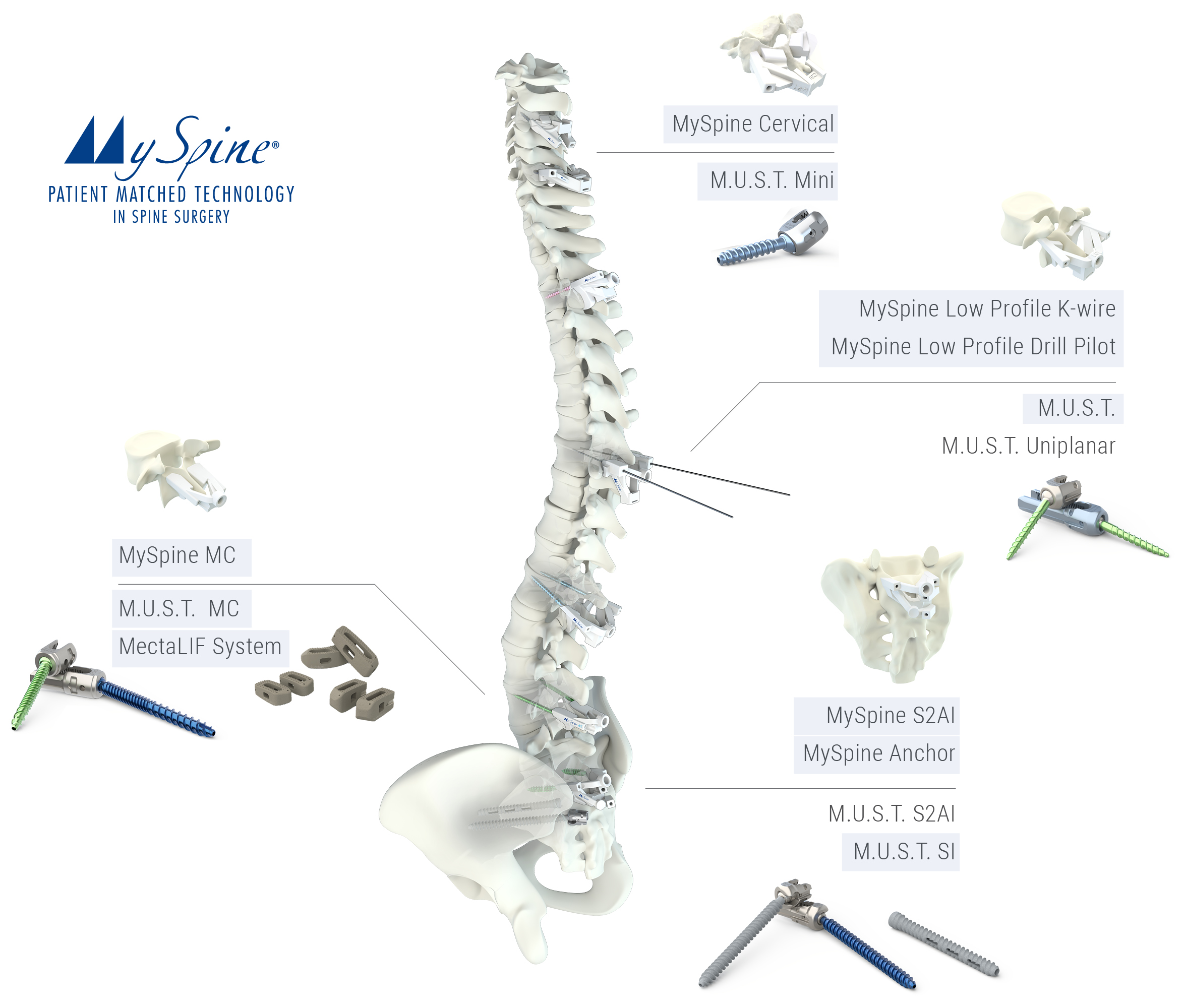 MySpine - Patient Matched Technology in Spine Surgery