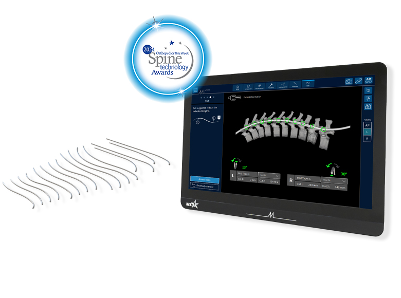 NextAR Rod Optimizer